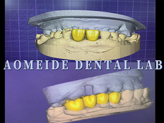 AOMEIDE Laboratorio dentale