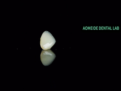 Ponte della corona in ceramica