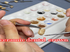 Corona dentale in zirconia trasparente dall'aspetto naturale con eccellente durata e adattamento preciso