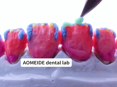 Forza Estetica naturale Corona di zirconia solida Perfetta per denti singoli o multipli