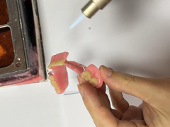 Soluzione per masticare confortevole e rimovibile