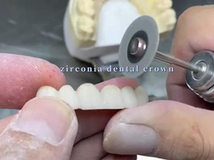 Resistenza Corona dentale in zirconia per un sorriso estetico Adattamento preciso Eccellente biocompatibilità
