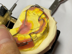 Apparecchio ortodontico su misura con buona conservazione e caratteristiche regolabili