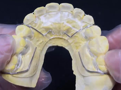 Confortevole da indossare il conservatore Hawley dell'AMD Dental Lab per un'ortodonzia sicura e sana