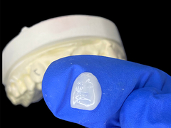 IPS e.max Finiture per incisivi in tonalità A1 Estetica naturale per sorrisi impeccabili