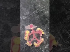 Protesi parziale flessibile Nesbit per comfort e durata nella sostituzione dei denti