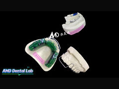 Una gamma completa di soluzioni ortodontiche personalizzate realizzate con precisione, comfort e cura.