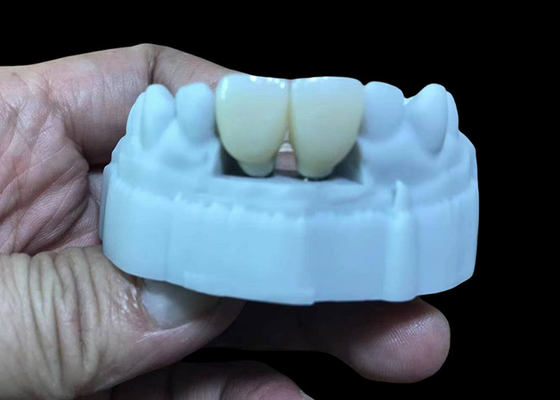 comprare Sostituire la corona dell' impianto dentale con una base di titanio a vite e una corona di zirconia online manufacture