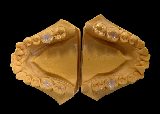 comprare Infissi in ceramica biocompatibili Infissi di restauro dentale senza saldature con resistenza alle macchie online manufacture