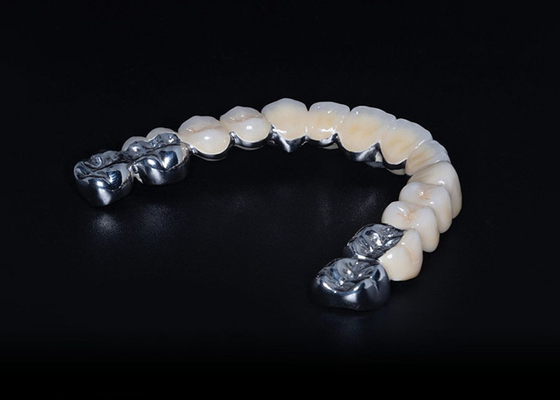 comprare Porcellana biocompatibile ad alta resistenza fusa a corona metallica adatta a misura online manufacture