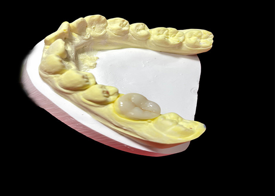 comprare Infissi e infissi in ceramica di alta qualità per la restauro dei denti senza saldature e a lunga durata online manufacture