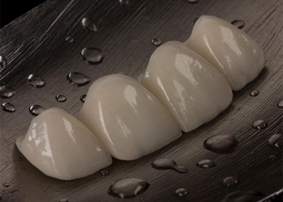 comprare Ponte di corona in ceramica personalizzabile per denti mancanti online manufacture