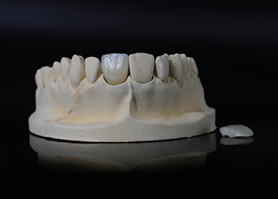 comprare Porcellana traslucida Emax Veneer per un'ottima vestibilità / estetica naturale online manufacture