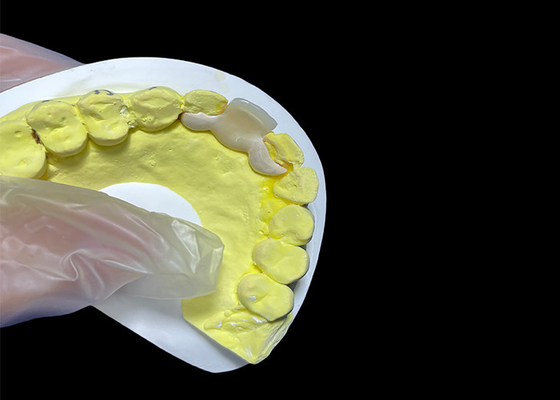 comprare Corone dentale ceramica di aspetto naturale HPP ponte ceramico legato facile pulizia online manufacture