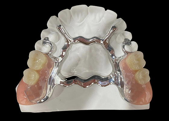 comprare Denti rimovibili parziali a base metallica e resina acrilica per un'aspetto sicuro e naturale online manufacture