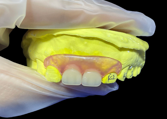 comprare Sostituzione della protesi paritale flessibile per masticare e parlare comodamente online manufacture