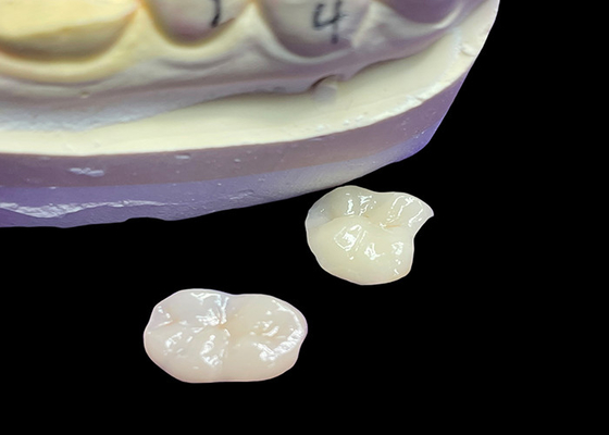comprare IPS e.max Infissi e infissi in ceramica per il restauro molare Estetica naturale e durata superiore per risultati duraturi online manufacture