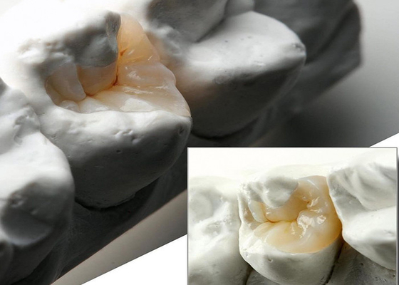 comprare Infissi ceramici naturali e infissi per la restaurazione dentale precisa dal nostro laboratorio odontoiatrico esperto online manufacture