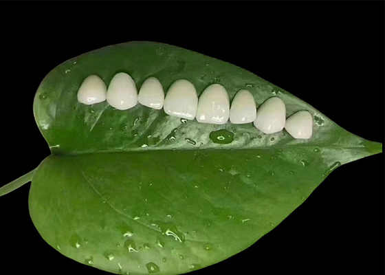 comprare Preparazione minima Veneer di porcellana EMAX per trattamenti dentali cosmetici online manufacture