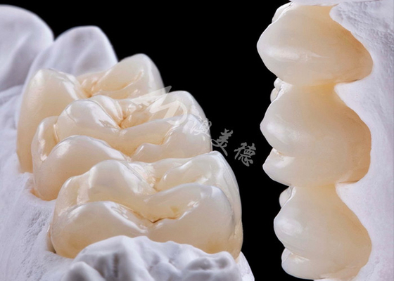 comprare Corone dentale in zirconia di alta resistenza per la sostituzione di denti singoli o multipli online manufacture