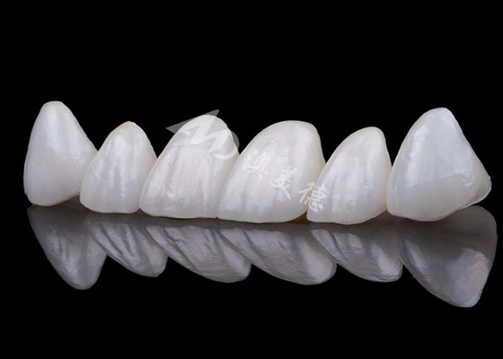 comprare Corone di denti di zirconio di aspetto naturale Resistenza alle macchie online manufacture
