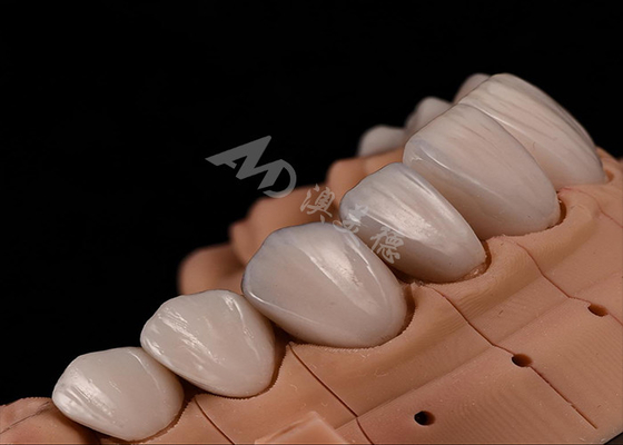 comprare Forza Estetica naturale denti corone di zirconia per una resistenza ai frammenti adatta online manufacture