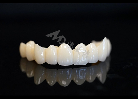 comprare Una corona di zirconia solida fatta con precisione per una perfetta forma e comfort dentale. online manufacture