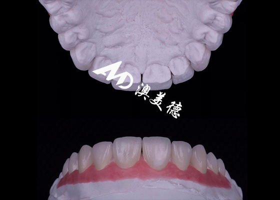comprare Traslucidità EMAX Veneer di porcellana resistente alle macchie / resistenza online manufacture