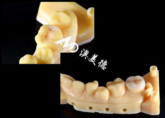 comprare Infissi e infissi in ceramica di precisione per la riparazione dei denti con colore naturale Materiale ipoallergenico e adatta senza cuciture per un comfort e una durata superiori online manufacture