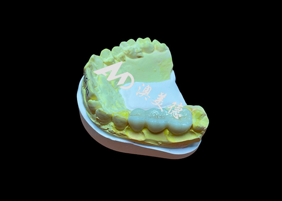 comprare Superficie liscia personalizzata Corona dentale in zirconia Alta biocompatibilità Resistenza alle macchie online manufacture