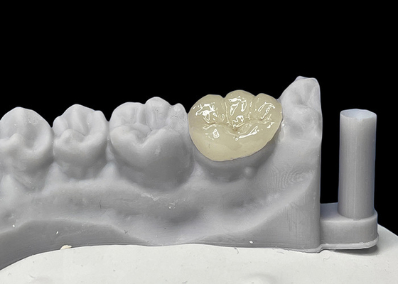 comprare Infissi dentistici ceramici accurati, infissi di porcellana e infissi approvati dalla FDA. online manufacture