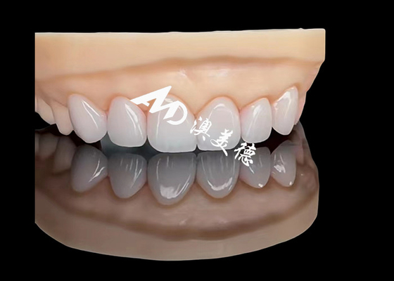 comprare Porcellana EMAX Veneer Ripristino estetico di alta precisione con una durata superiore online manufacture
