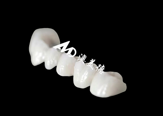 comprare Una corona dentale a arco pieno di Zriconia con un aspetto naturale sorprendente online manufacture