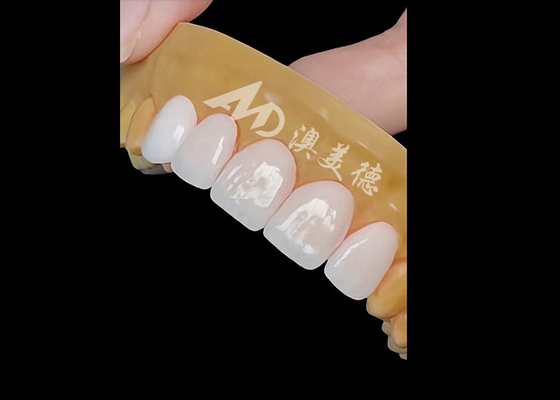 comprare Corona dentale di zirconia di precisione per restauri naturali e duraturi online manufacture
