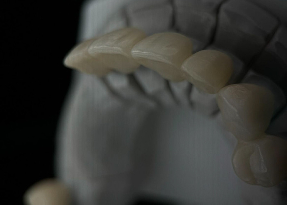 comprare Corone dentale in zirconia monolitica con trasparenza e resistenza online manufacture