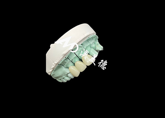comprare Emax Corona ceramica Soluzione personalizzabile e conveniente per il restauro dentale online manufacture
