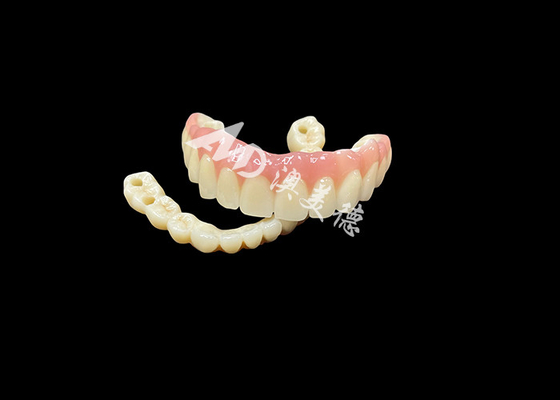 comprare Protesi a sostegno di impianti ponte La soluzione dentistica definitiva per i denti mancanti online manufacture