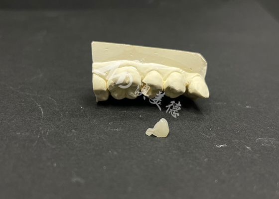 comprare Infisso in ceramica Emax ipoallergenico e resistente alle macchie per la riparazione accurata dei denti danneggiati online manufacture