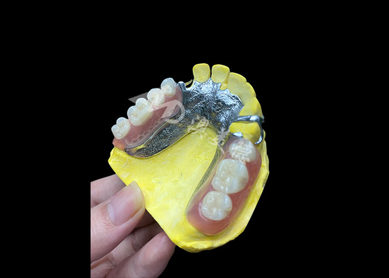 comprare Protesi parziali a fusione regolabile per un maggiore comfort e stabilità, perfette per masticare e parlare online manufacture