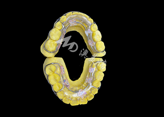 comprare Ritenitore Beagle per un efficace mantenimento del sorriso e un allineamento duraturo online manufacture