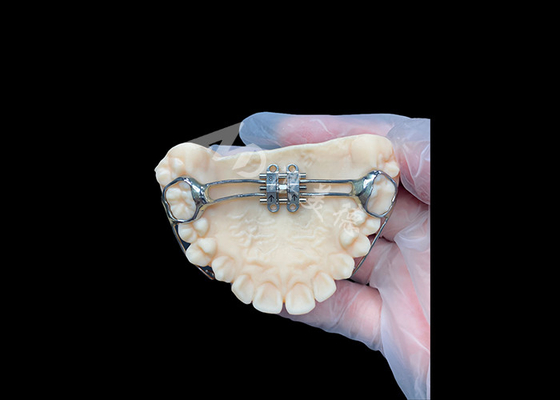 comprare Espansione palatina MSE Apparecchi ortodontici innovativi per un allineamento efficace dei denti online manufacture