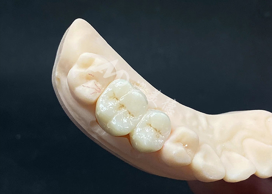 comprare Corona di zirconia ad alta traslucidità di aspetto naturale con resistenza ai frantumi online manufacture