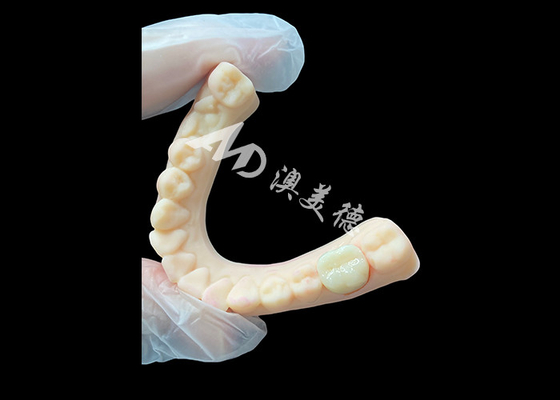 comprare Corone dentale posteriore in ceramica circonia ad alta resistenza online manufacture