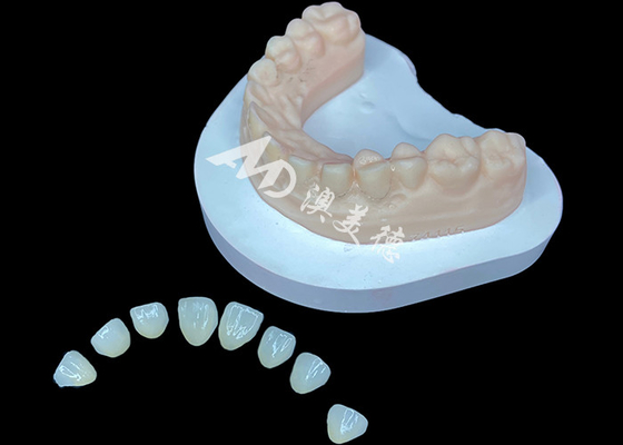 comprare IPS e.max Veneer Soluzione estetica premium per trasformazioni di sorriso mozzafiato online manufacture