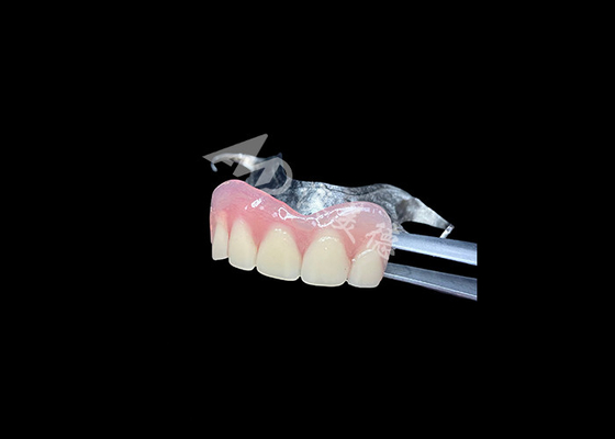 comprare Protesi parziali in fuso di lunga durata Facile manutenzione per una migliore masticazione e un sorriso perfetto online manufacture