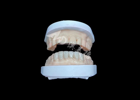 comprare IPS Emax Veneers Restauri di aspetto naturale per sorrisi estetici online manufacture