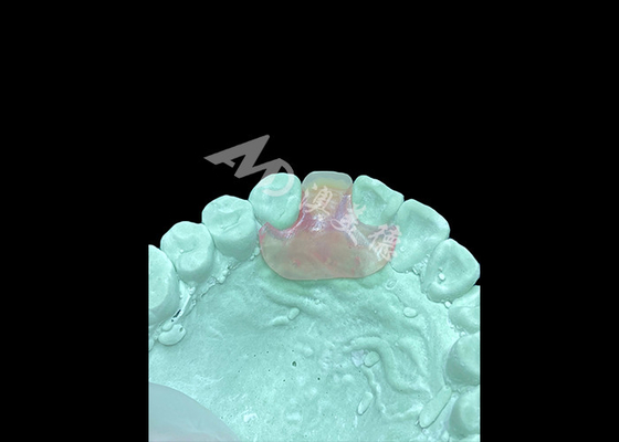 comprare Protesi flessibile Nesbit leggera e comoda per la sostituzione di un singolo dente online manufacture