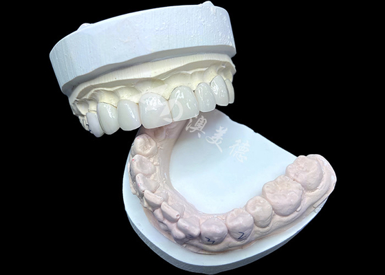 comprare Le finiture IPS e.max in tonalità BL2 raggiungono un'estetica naturale mozzafiato con 8 unità perfettamente realizzate online manufacture
