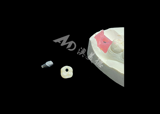 comprare Corone per impianti dentali di lunga durata che rivoluzionano la procedura di odontoiatria rigenerativa online manufacture