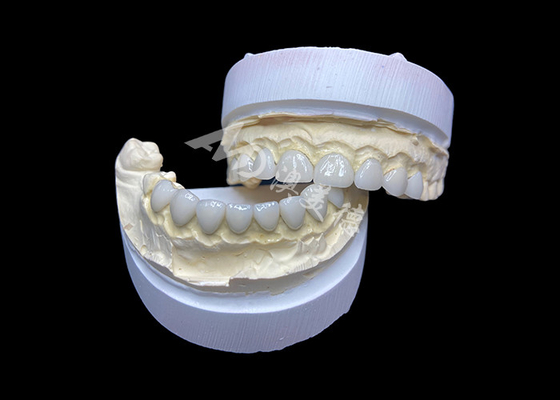 comprare Personalizzazione Veneer in vetro ultra sottile in ceramica ad alta trasparenza per un sorriso naturale online manufacture